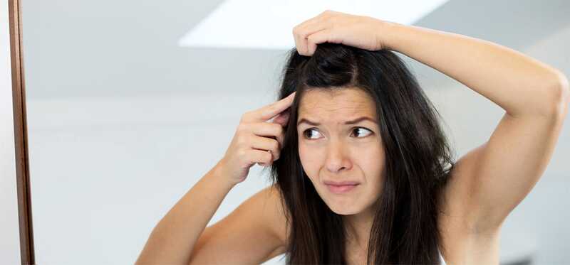 Può la forfora provocare la perdita dei capelli?