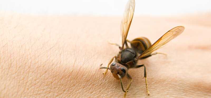 10 efficaci rimedi domestici per Bug Bites