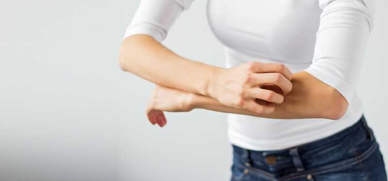 10 efficaci rimedi domestici per trattare le allergie della pelle