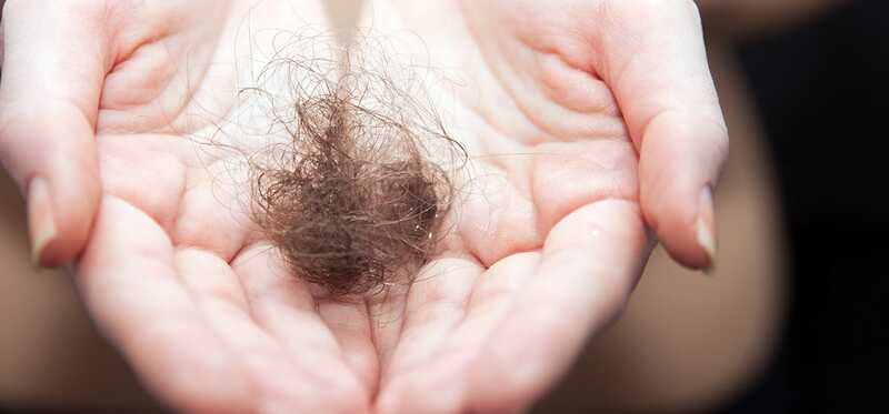 Perdita di capelli di folliculite - Cause, precauzioni e trattamento