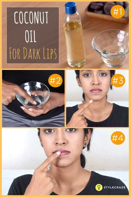 10 modi dimostrati per sbarazzarsi naturalmente delle labbra scure - ha lavorato per il 99% di persone che hanno provato