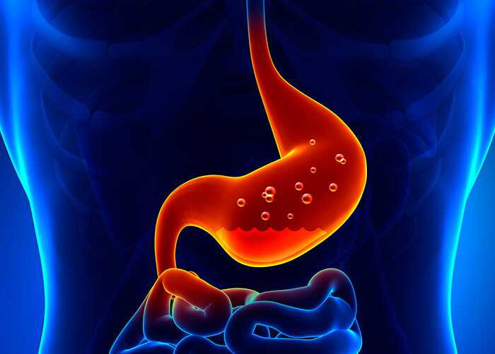 Sindrome dell'intestino irritabile (IBS) - Piano di dieta e trattamento