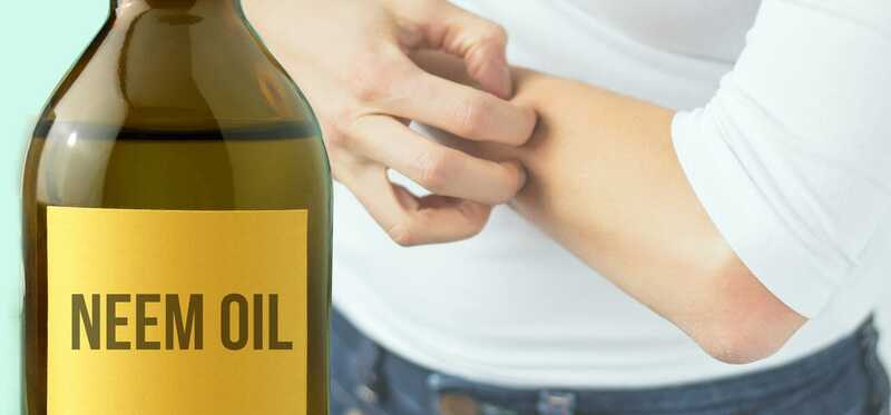 L'olio di Neem è utile per trattare la scabbia?
