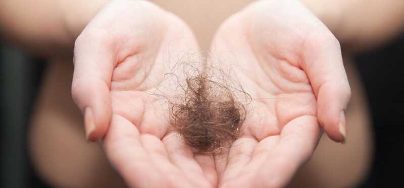 Top 5 Cure permanenti per curare la perdita dei capelli