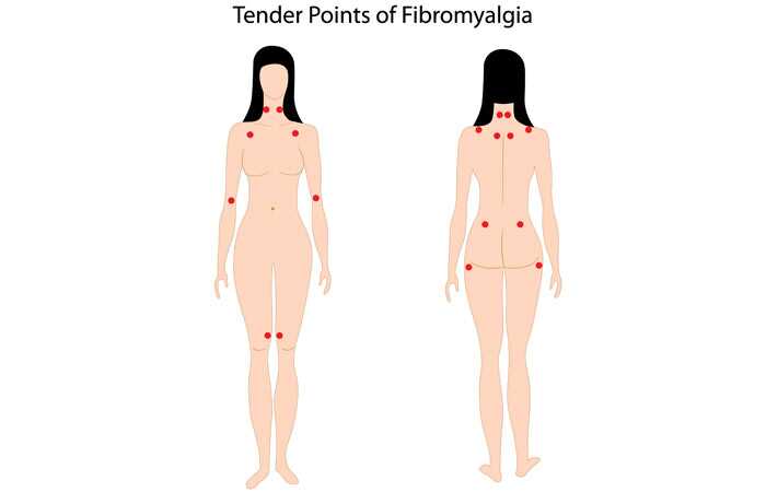 8 posizioni di yoga facili che curano rapidamente la fibromialgia