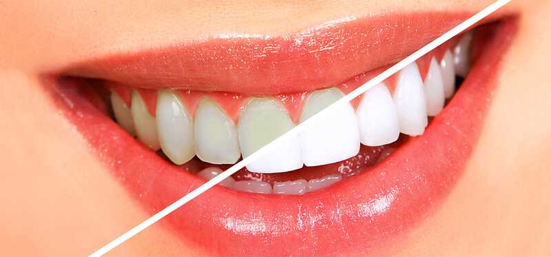 5 effektive måder at have god oral sundhed på
