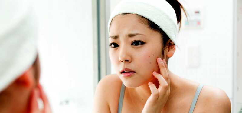 Hvordan man bruger Clove olie til at behandle acne?