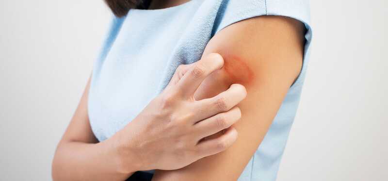 Ako používať Peroxid vodíka na liečbu kožných ochorení?