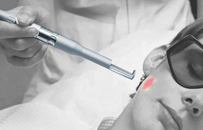 9 vedľajších účinkov laserových vlasov Odstránenie liečby, ktoré by ste mali určite vedieť