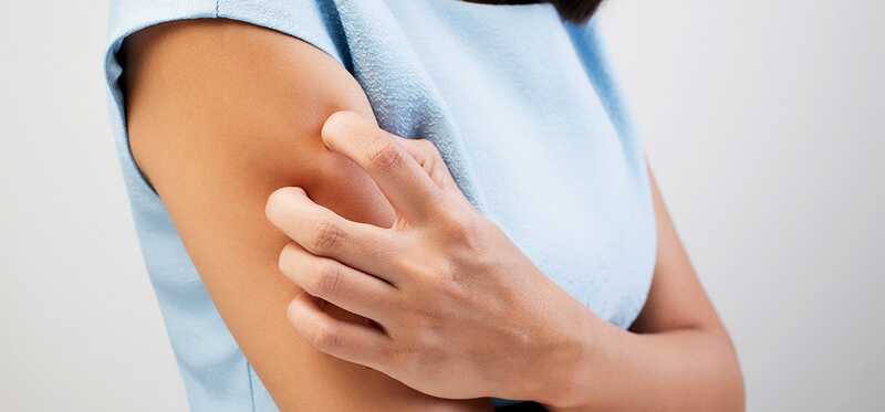 10 príznakov a liečba alergií na suchú pokožku